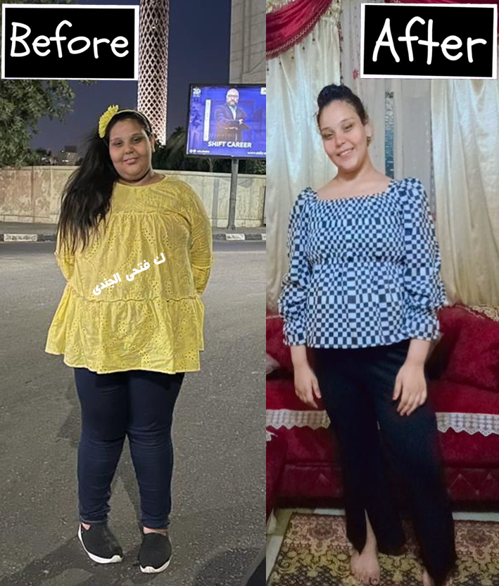 رؤية — قبل وبعد